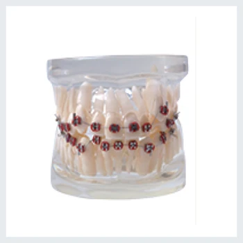 1 KOS Zobne Ortodontskega Model tip Brez nosilec vsi kovinski nosilec pol kovinski&pol keramični nosilec vseh keramičnih nosilec