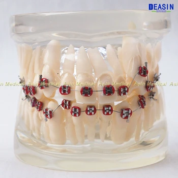 1 pc Orthodontists zob model S kovinsko & keramični oklepajih Orto Kovinski zobozdravnik pacientu študentov učni model Deasin