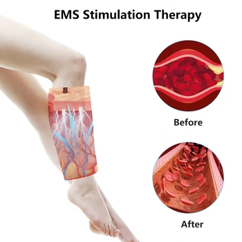 EMS Tele Massager hujšanje Fat Odstranjevalec Noge Gorijo Maščobe Instrument Masaža Pralni Krčne Žile Fizioterapija Blaži Utrujenost