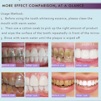 RtopR Beljenje Zob Bistvo Madežev Rumene Zobe Zdravljenje Dim Aparat Plaketo Zobni Ustno Higieno Odstranite Beljenje Zob Nego