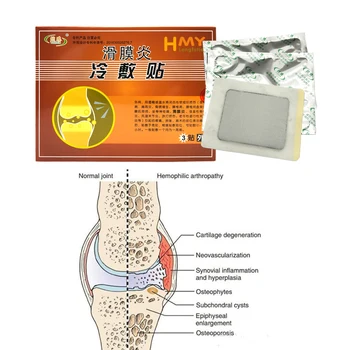 ZB omete kitajskih medicinskih mavca Bolečine v Lajšanju Obliž Kolena Revmatoidni Artritis Kitajski Bolečine Obliž Zdravje Masaža