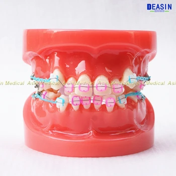 1 pc Orthodontists zob model S kovinsko & keramični oklepajih Orto Kovinski zobozdravnik pacientu študentov učni model Deasin