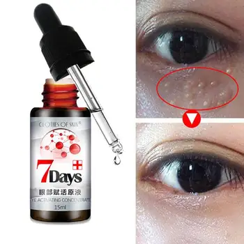 Oči oživljanju raztopina podočnjake Odstranite krema Proti gubam zrna linije anti-ag Odstranjevanje maščobe Posvetlite oči Oči vrečko J2A0