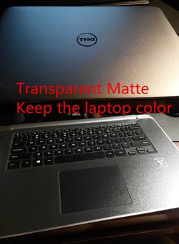 Posebno Laptop Ogljikovih vlaken vinil Kože Nalepke Kritje stražar Za HP ProBook 450 G3 3. generacije 15.6