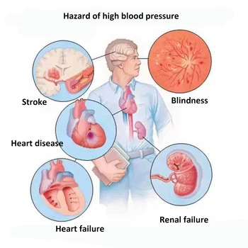 10Pcs Anti hipertenzije zdravljenje obliž glavobol glavo bolečin v Kitajski medicini nadzor zniža krvni tlak medicinske mavca