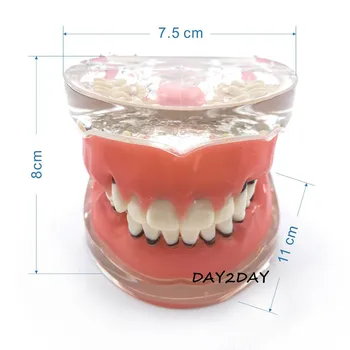 Odraslih Patološkega Periodontal disease #4017 Ustni Izobraževanje Zobni Študija Zob Model