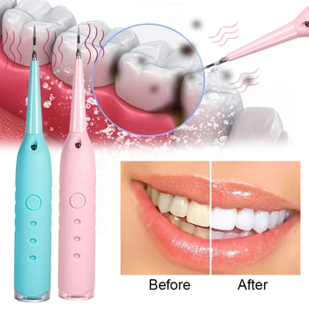 Ultrazvočne Zobne Matematika Odstranjevalec Naprave Zobne Madeže Tartar Plaque Remover Orodje, Zobozdravnik, Beljenje Zob, za Ustno Higieno