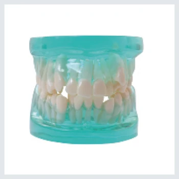 1 KOS Zobne Ortodontskega Model tip Brez nosilec vsi kovinski nosilec pol kovinski&pol keramični nosilec vseh keramičnih nosilec