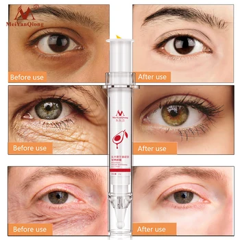 Karitejevo Kolagena, Učvrstitev Eye Cream Anti-Aging Popravila Kožo, Oči Odstranite Temno Krog Oči Vrečko Vlažilne Dviganje Kožo, Oči