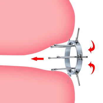 Kovinski Nastavljiv Veliko Analni Igrače Extreme Vaginalne Anus Dilator Vaginalne Spekuluma Big Butt Plug Odraslih Erotično Sex Igrače Za Moške, Ženske