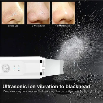Obraza Pore Deap Čiščenje Blackhead Ultrazvočno odstranjevanje barve Kože Scruber EMS LED Lepota Naprave Daleč Ir Telesa, Hujšanje Massager
