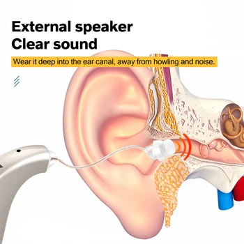 VHP-1206 Najboljši Digitalni Slušni Pripomočki za Uho Ojačevalec Zvoka za ponovno Polnjenje Nadgrajeno na Uho-kavelj Pomoči za Srednje Hude Izgube