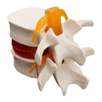 ABSF Človeške Anatomije Okostje Ledvene Hrbtenice Disk Herniation Poučevanja Model Možganov, Lobanje Travmatičnih Šolske Potrebščine Medicinske Instrume