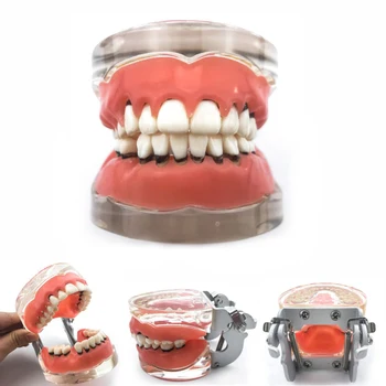Odraslih Patološkega Periodontal disease #4017 Ustni Izobraževanje Zobni Študija Zob Model